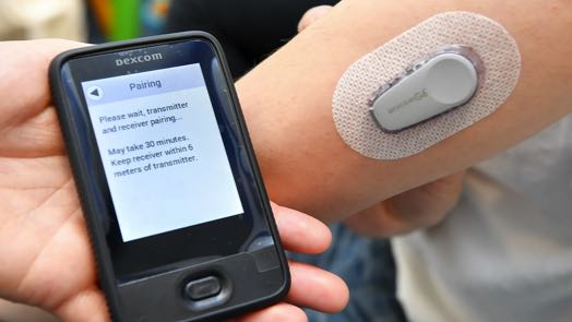DexCom Inc прогноз на 2022 и 2023 год